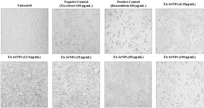 Facile green synthesis and characterization of Terminalia arjuna bark phenolic–selenium nanogel: a biocompatible and green nano-biomaterial for multifaceted biological applications